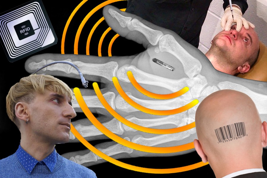 2016-07-06-biohacking